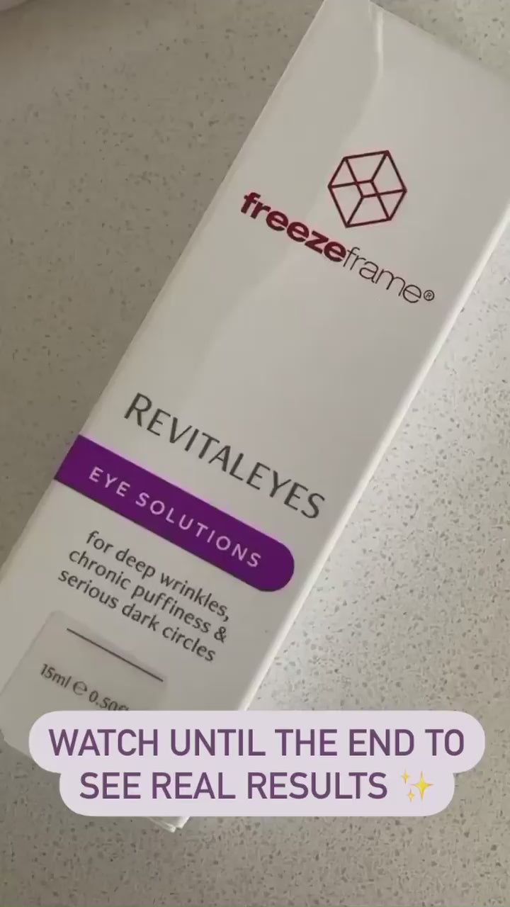 Revitaleyes